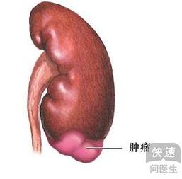 肾癌可以吃线瓜吗,线瓜的适宜与禁忌